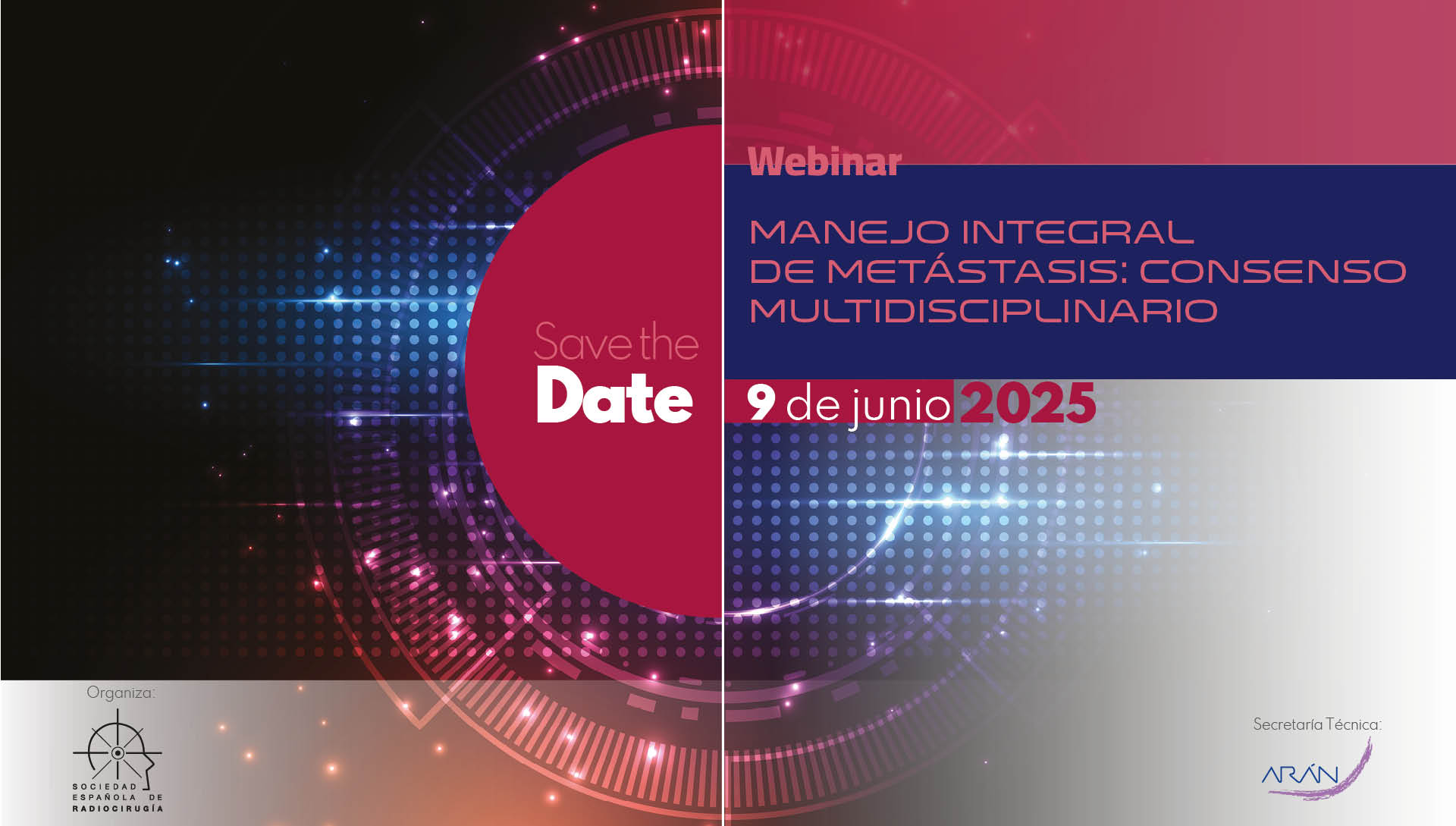 Webinar Manejo Integral de metástasis consenso multidisciplinario